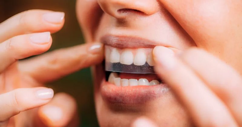 How Often Should You Use Teeth Whitening Strips? – Afterthought