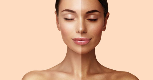 How To Remove Skin Tan In One Day?