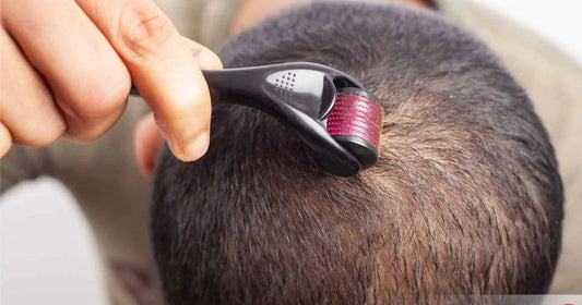 Is Derma Roller Effective for Hair Regrowth?