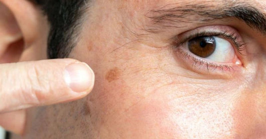 Which Face Wash Is Best For Dark Spots?