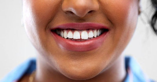 How To Close Teeth Gaps Naturally?