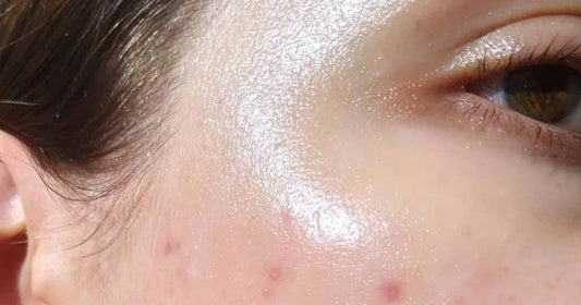 How To Heal Damaged Skin on Face, Fast?
