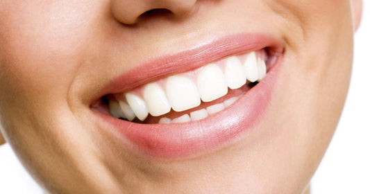 How To Keep Teeth White After Whitening?