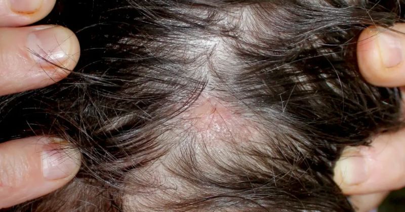 How To Prevent Hair Fall Due To Air Conditioner? – Afterthought