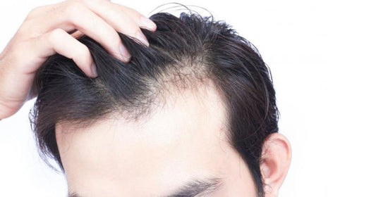 How To Prevent Hair Fall Due To Sweating?