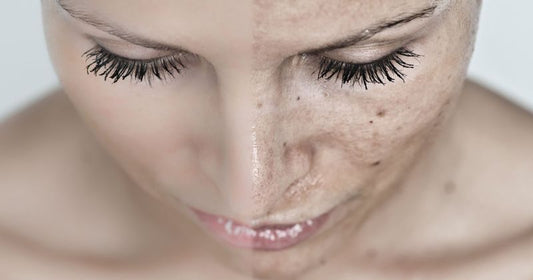 How To Remove Deep Dirt From Skin?