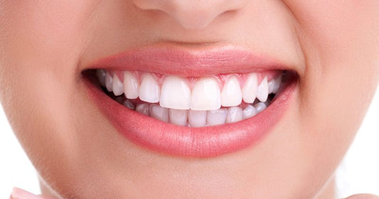 How To Whiten Your Teeth In A Week?