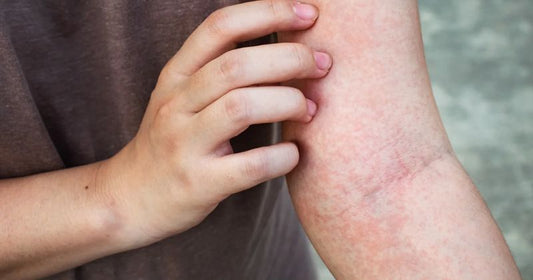 What Causes Extremely Itchy Skin? Top 9 Causes Listed.