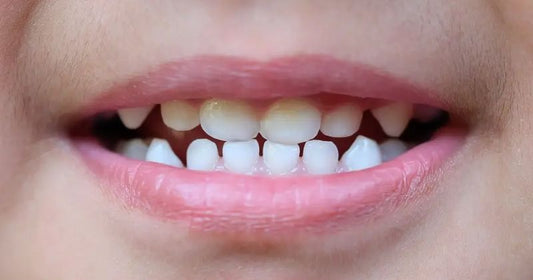 What Is The Difference Between Milk Teeth and Permanent Teeth?