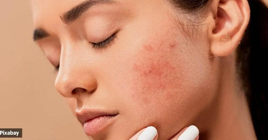 Which Facial Is Good For Sensitive Skin?