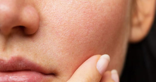 Which Serum Is Best For Skin Tightening?